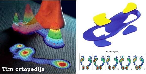 Ortopedski ulošci po mjeri za laganu obuću uz garanciju 6 mjeseci za cijelu Hrvatsku za 135kn!