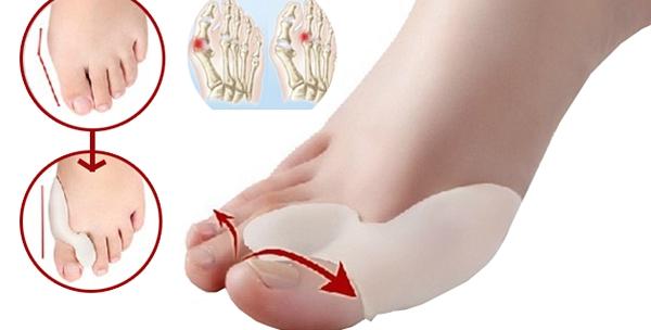 Hallux Valgus, čukljevi – 2 silikonska štitnika za deformirane nožne palčeve uz uključenu dostavu