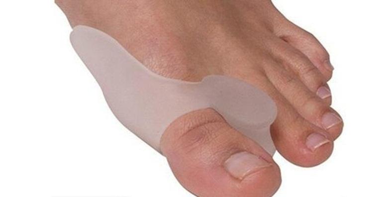 2 štitnika za deformirane palčeve – hallux valgus (čukalj) za 54 kn!