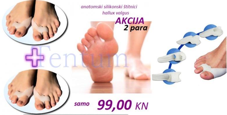 Riješite se čukljeva – 4 anatomska štitnika za deformirane nožne palčeve za 99kn!