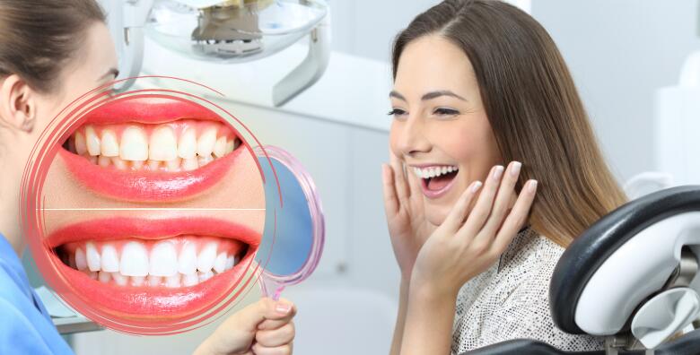 Izbjeljivanje zubi LED lampom (Zoom tehnologija), čišćenje kamenca, poliranje i pjeskarenje zubi uz pregled u Ordinaciji dentalne medicine Martina Stublić