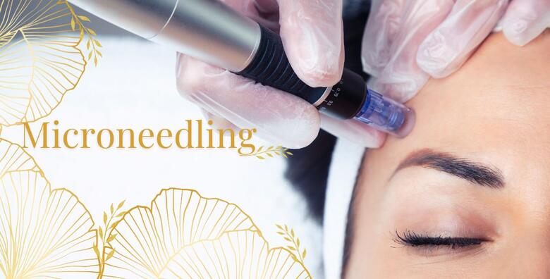 Microneedling – pomladite lice prirodnim putem te aktivirajte proizvodnju kolagena i elastina u Salonu ljepote Green line body